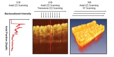 OCT成像系统(医疗)图片2 OCT成像系统(医疗)图片2